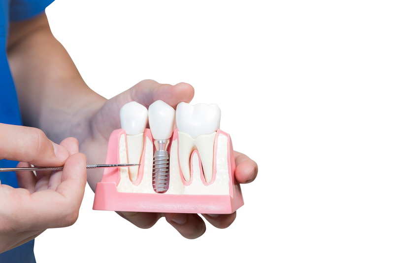 SingleTooth_WEB SingleTooth_WEB